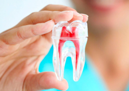 Come alleviare il mal di denti